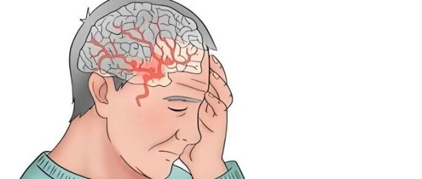 这种头痛要人命 认清信号别硬扛