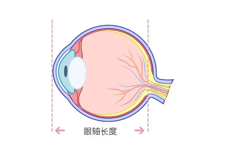 孩子配镜只做验光?漏掉这几步,眼镜可能白配了