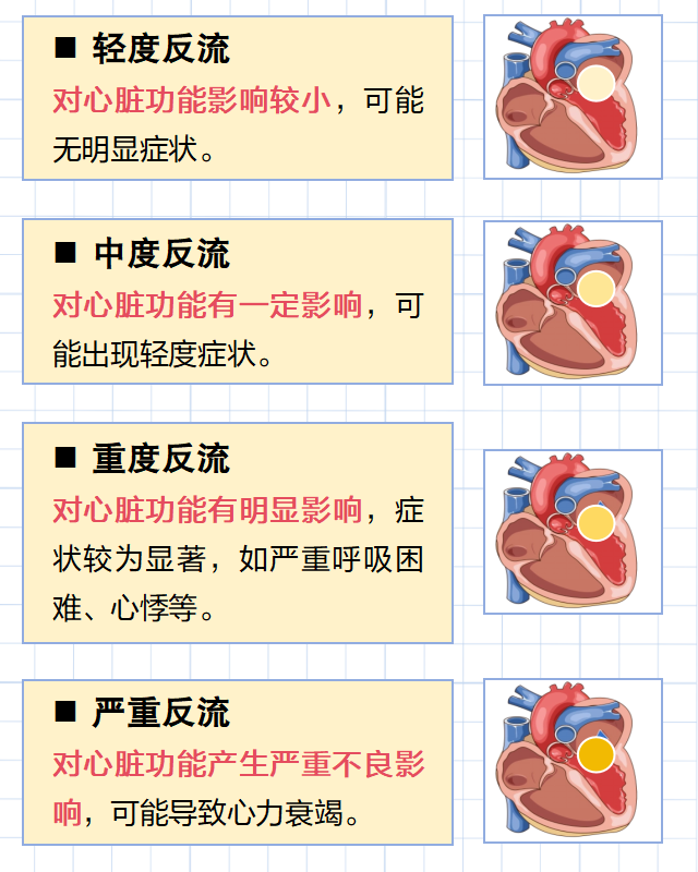 心脏瓣膜轻度反流？是心脏“阀门”破损了吗？