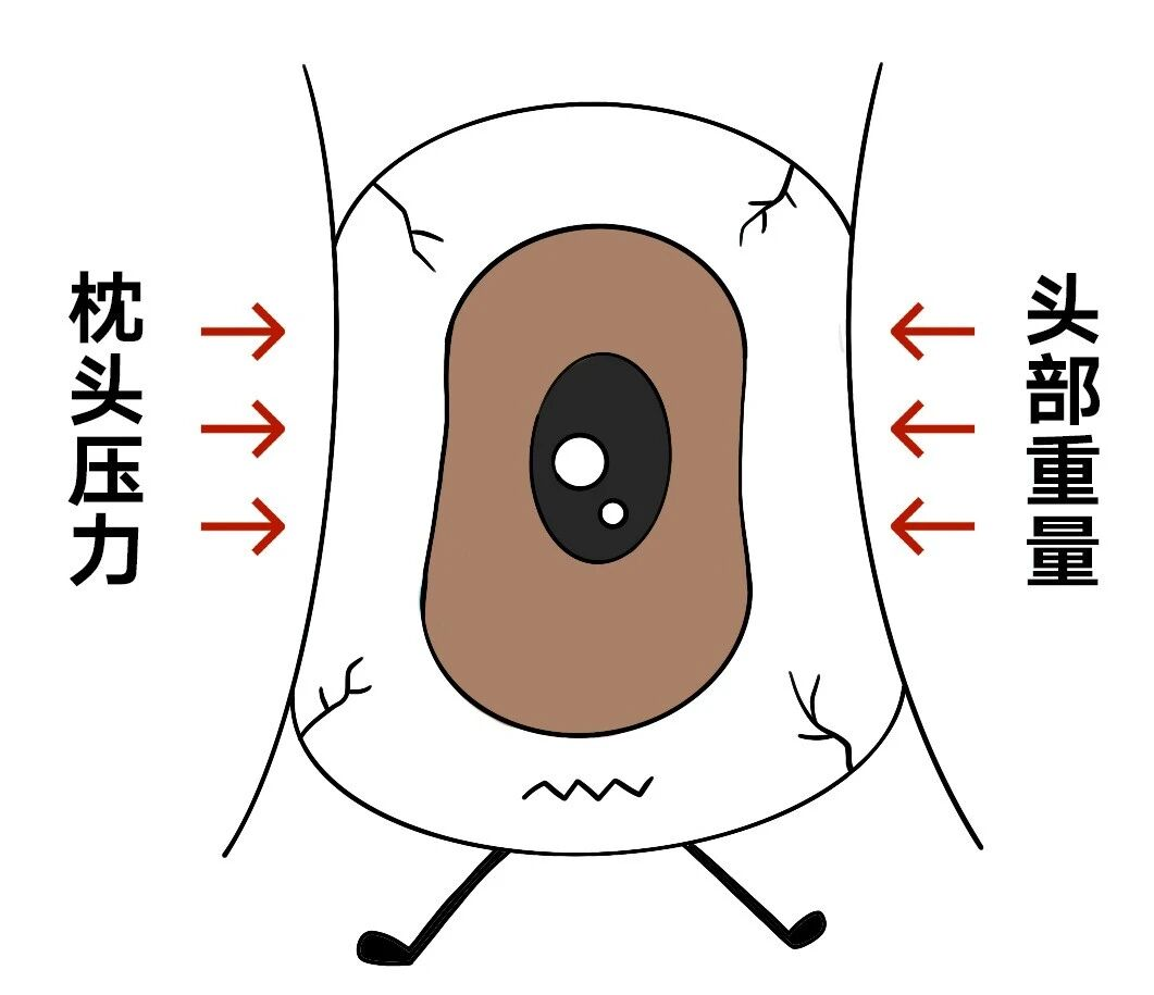 巨巨巨伤眼!别再用这个姿势玩手机了……