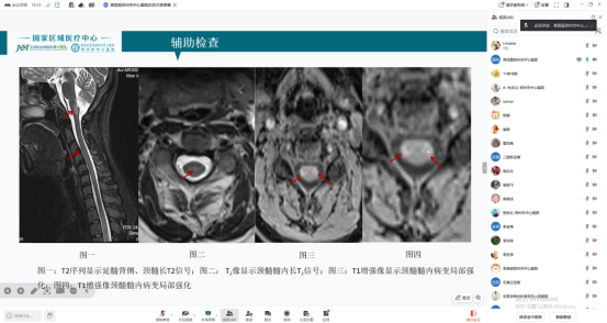 让“罕见”被看见 让生命有“奇迹”| 我院构建罕见病诊疗全链条体系，打造区域“郑州模式”