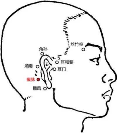 丨跟我学腧穴丨天牖穴、翳风穴、瘈脉穴、颅息穴、角孙穴、耳门穴、耳和髎穴、丝竹空穴