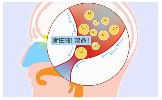 迎风流泪、无故溢泪?你的泪道可能正在“堵车”