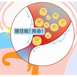 迎风流泪、无故溢泪？你的泪道可能正在“堵车”