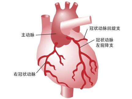 做完心脏支架/药物球囊,血管不再堵?真的可以无拘无束放飞自我吗?