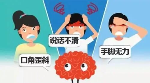 当心睡梦中的“隐形杀手”——醒后卒中,醒来发现脑梗千万别等!