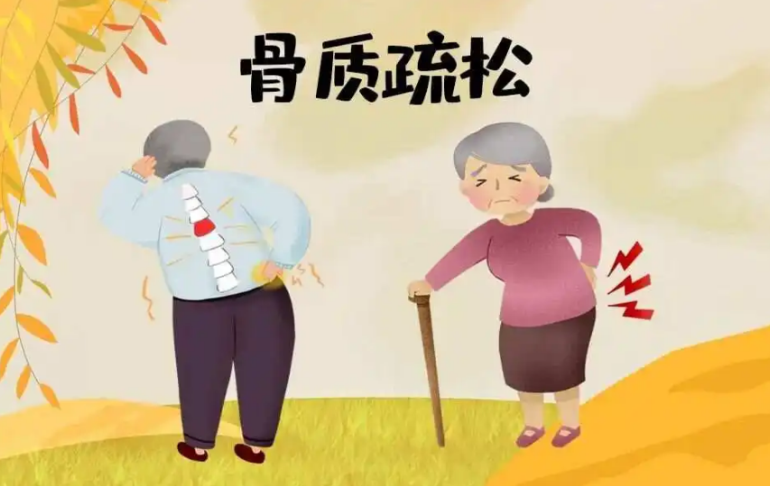 “寂静”的疾病——警惕骨质疏松