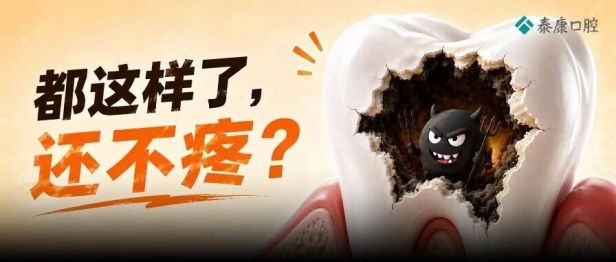 有蛀牙却一点都不疼？“隐形蛀牙”为什么更危险