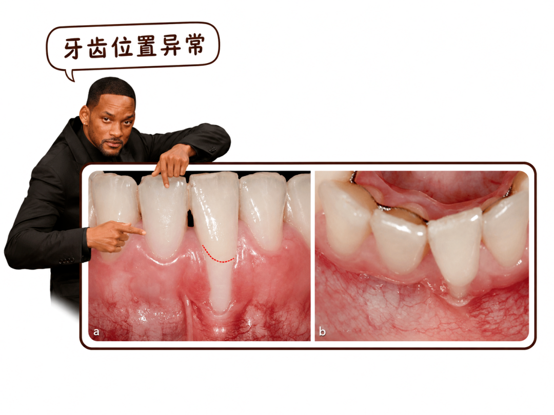 维 C、芦荟、椰子油…… 网上疯传的 4 种牙龈萎缩偏方,到底哪个真有用?