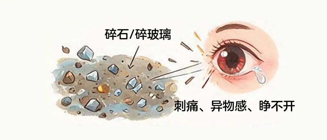 眼睛发出这些“求救信号”,别犹豫,马上去医院!