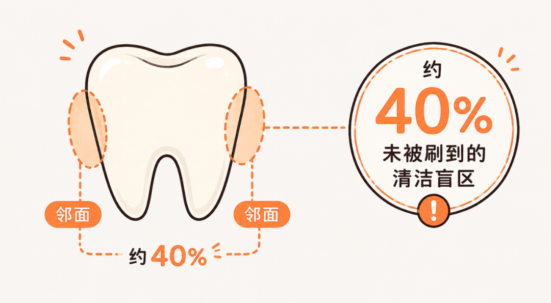 有蛀牙却一点都不疼?“隐形蛀牙”为什么更危险