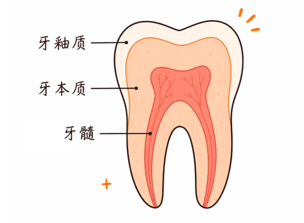 有蛀牙却一点都不疼?“隐形蛀牙”为什么更危险