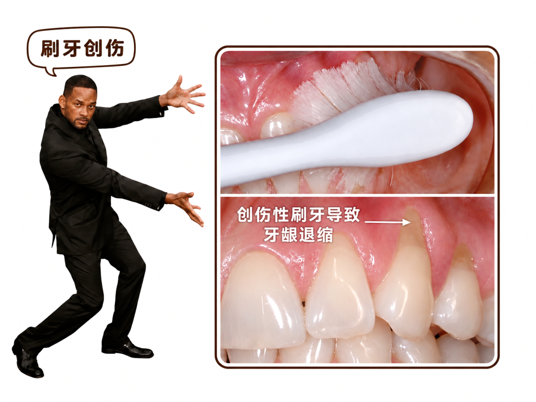 维 C、芦荟、椰子油…… 网上疯传的 4 种牙龈萎缩偏方,到底哪个真有用?