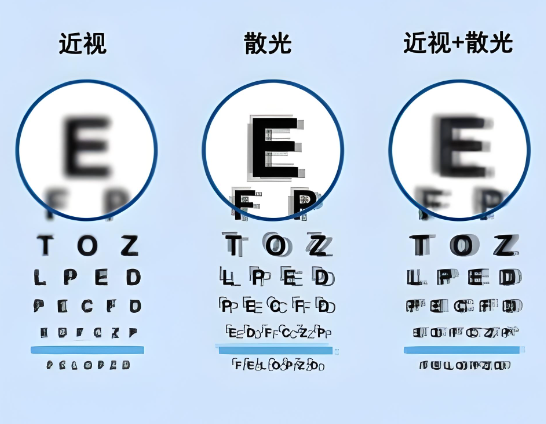 经常侧躺看手机会引起散光?眼科医生:这不是危言耸听