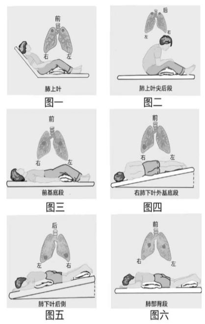 咳喘总不好?手把手教你给娃做呼吸管理