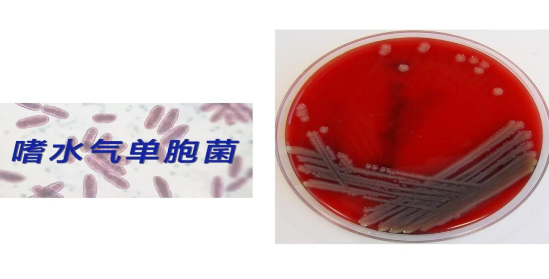 70%死亡率！重症监护室医护从死神手中抢回少年