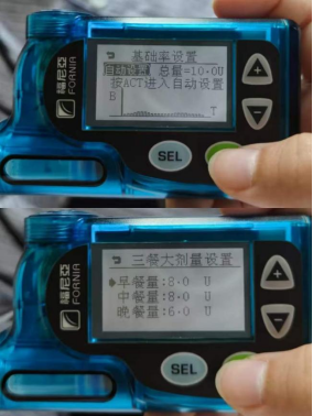 告别每日反复扎针!燕达医院内分泌科详解智能胰岛素泵