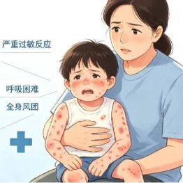 秋风起，防过敏！警惕儿童严重过敏反应