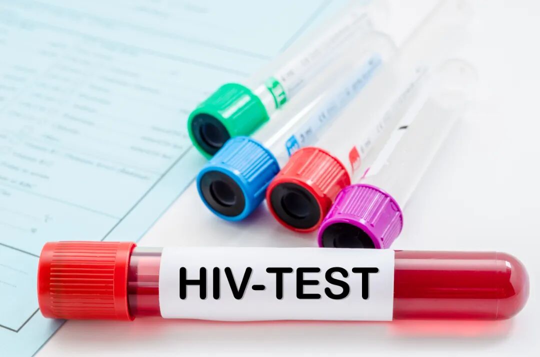 HIV 初筛有反应，就是确诊艾滋病吗？这份报告越早知道越好