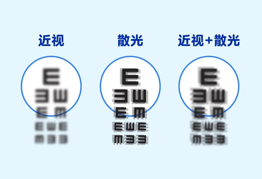 @老师：您是否看东西总有“重影”？