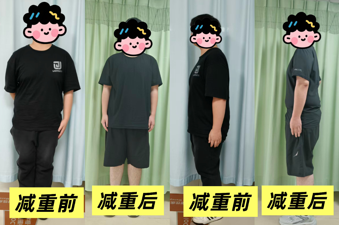 16名学员35天累计减重76.7公斤!我院“青春蜕变”暑期青少年减重训练营结营