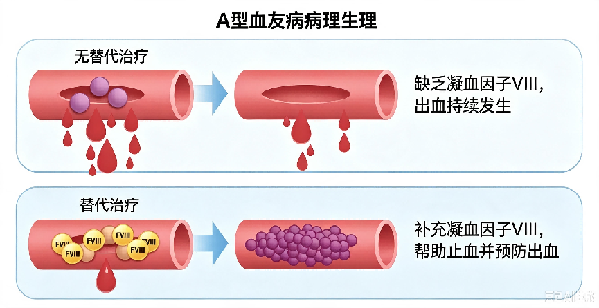 血友病是啥？揭开“玻璃人”背后的秘密