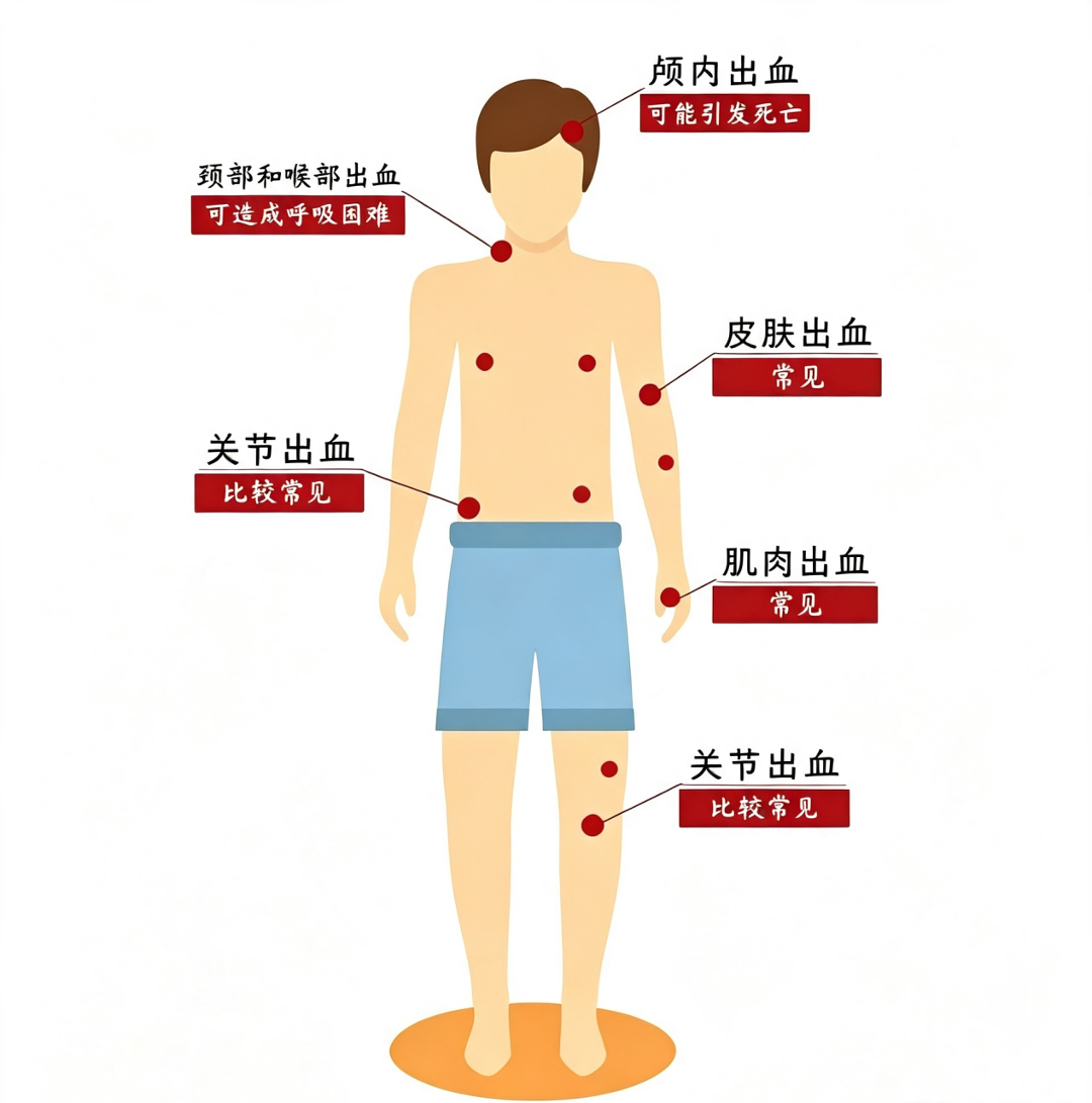 血友病是啥？揭开“玻璃人”背后的秘密
