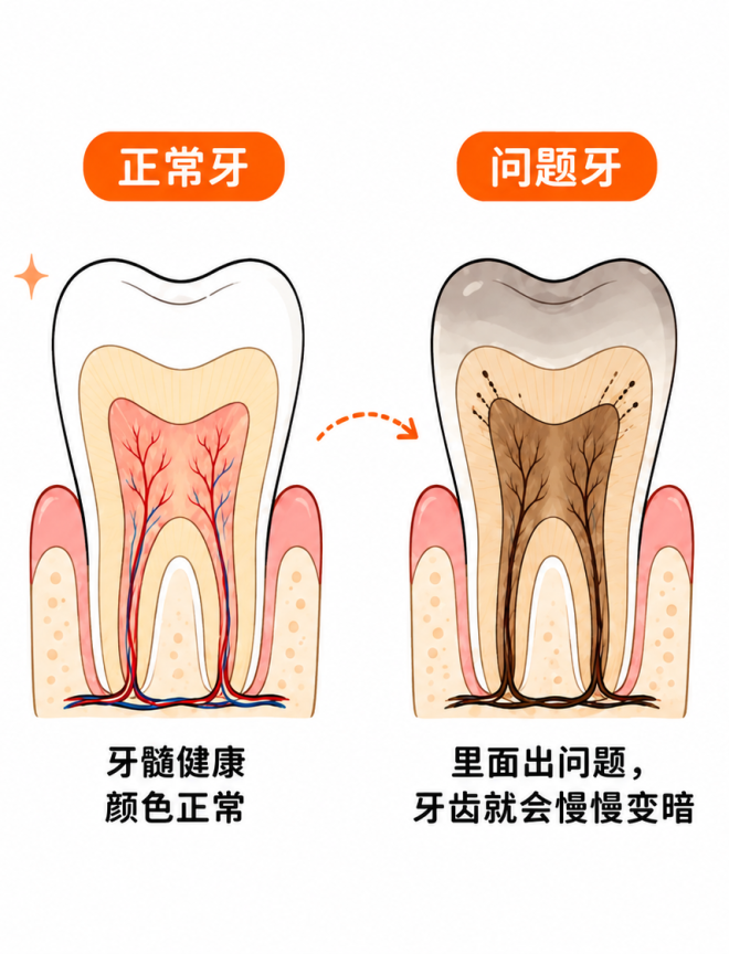 为什么有一颗牙在偷偷变色,他到底经历了什么?