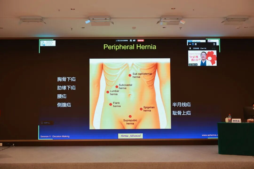 国际学术赋能 共话前沿技术|南京江北医院成功举办2026年亚太疝学会高级培训班(APHS)