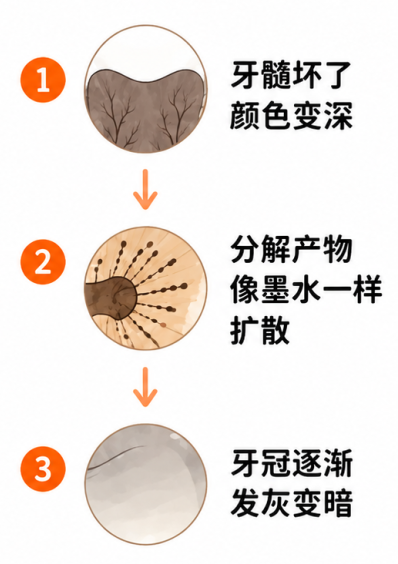 为什么有一颗牙在偷偷变色,他到底经历了什么?