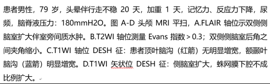 走不动、记性差、憋不住尿? 别都怪"老了"