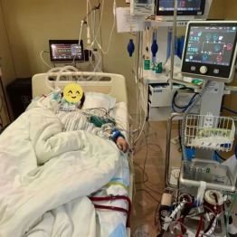鏖战生死晨昏｜七旬老人小肠穿孔诱发多器官衰竭，普外科携手重症医学科接力攻坚挽回生机