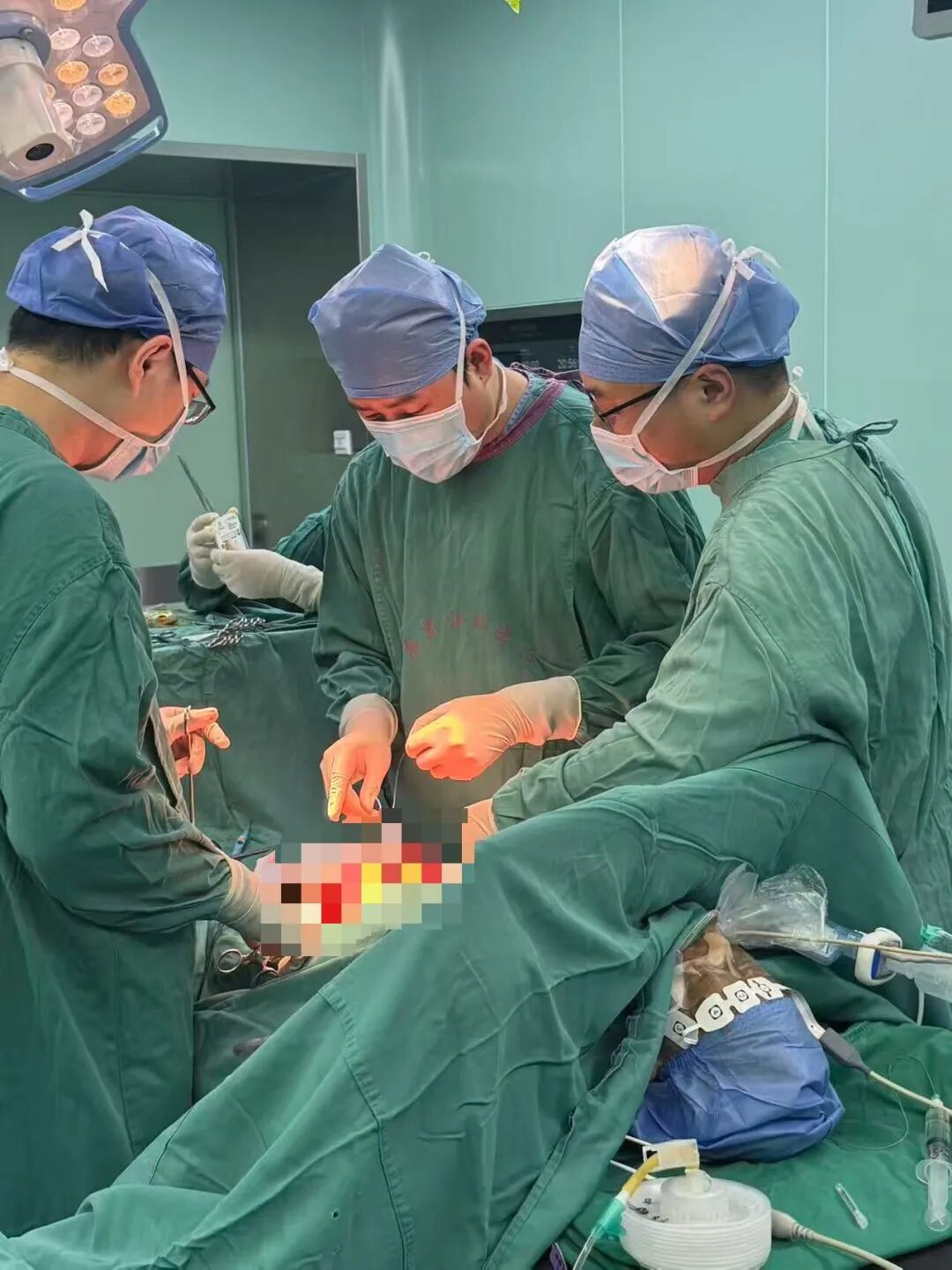 鏖战生死晨昏|七旬老人小肠穿孔诱发多器官衰竭,普外科携手重症医学科接力攻坚挽回生机