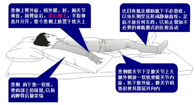 中风后 “卧床静养” 反而害了人?世界物理治疗日:抓住早期康复黄金期