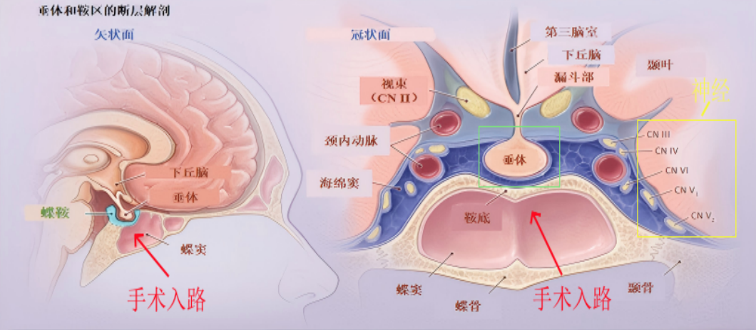 七旬老人突发“眼蒙”,入院检查发现是肿瘤作祟