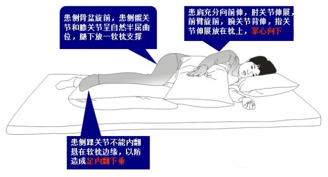中风后 “卧床静养” 反而害了人?世界物理治疗日:抓住早期康复黄金期