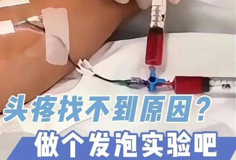 南京鼓楼医院集团宿迁医院心血管内科成功开展首例可降解卵圆孔未闭封堵器植入术