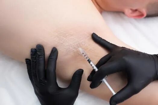 【健康科普】入秋了,腋臭还在?别让它继续困住你