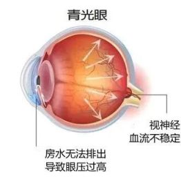 脾气不好，真的能把眼睛“气炸”？