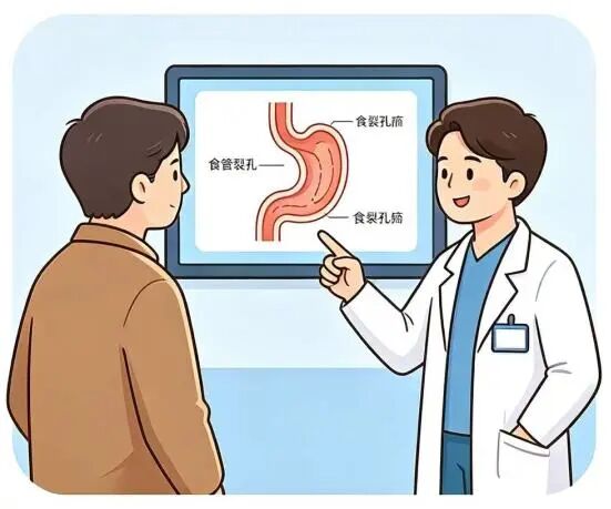 食管裂孔疝:别再让“烧心、反酸”偷走你的生活质量