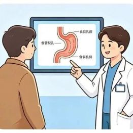 食管裂孔疝：别再让“烧心、反酸”偷走你的生活质量