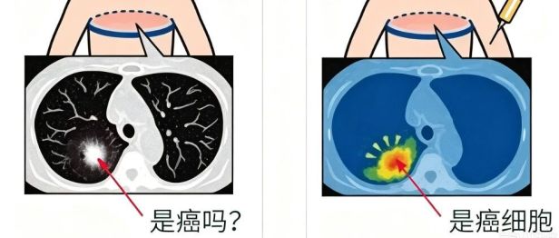 PET/CT vs 增强 CT，肿瘤检查该怎么选？一文看懂区别