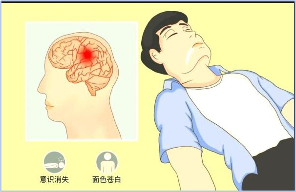 头部磕碰后突然抽搐?脑电图揪出脑内隐患!