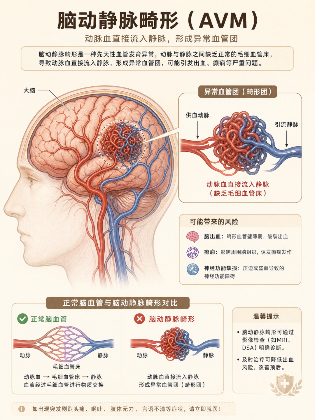 21岁小伙突发脑出血,命悬一线!复合手术室“一站式”精准救治,化险为夷