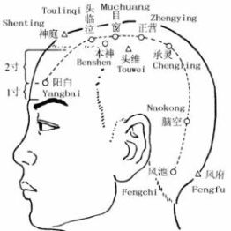 丨跟我学腧穴丨本神穴、阳白穴、头临泣穴、目窗穴、正营穴、承灵穴、脑空穴