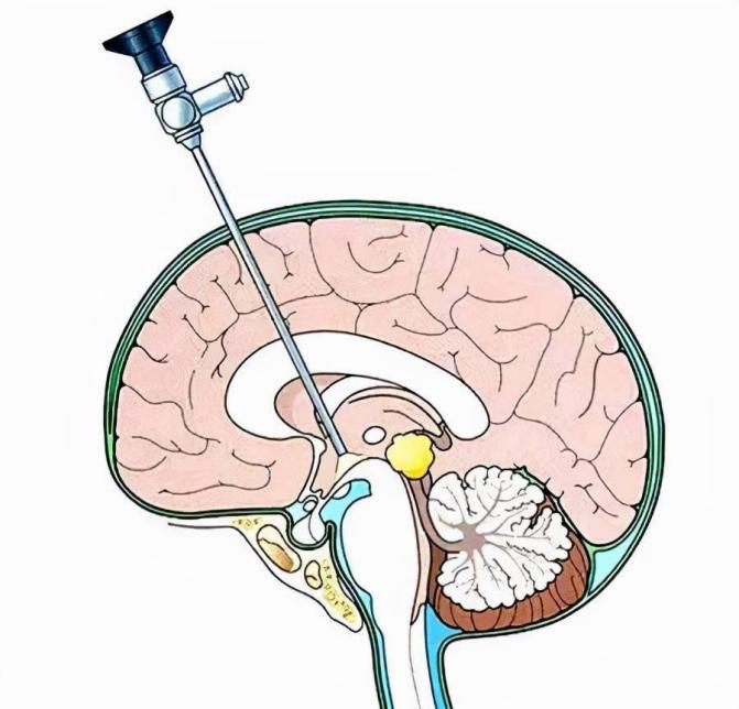 量一下孩子头围,出现这种情况要注意!