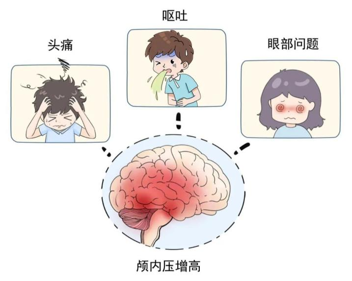 量一下孩子头围，出现这种情况要注意！