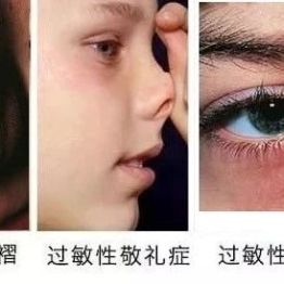 【健康科普】你们家娃会不会总流鼻涕、打喷嚏？