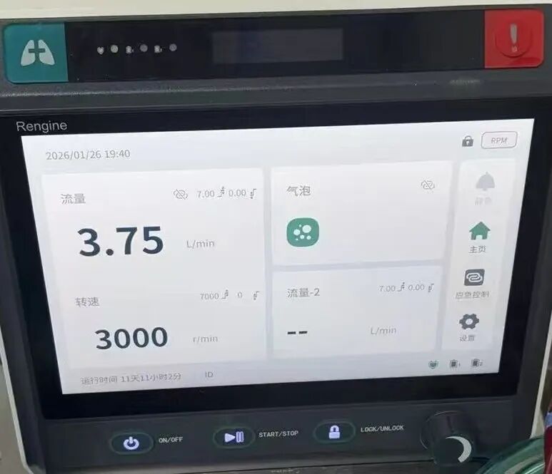硬核护航，突破心脏手术禁区——ECMO 辅助攻克复杂高危 PCI 术难题