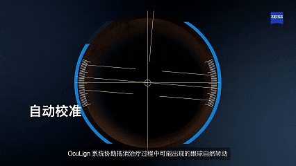 中秋国庆双节摘镜攻略:如何选择最适合自己的近视手术方式?